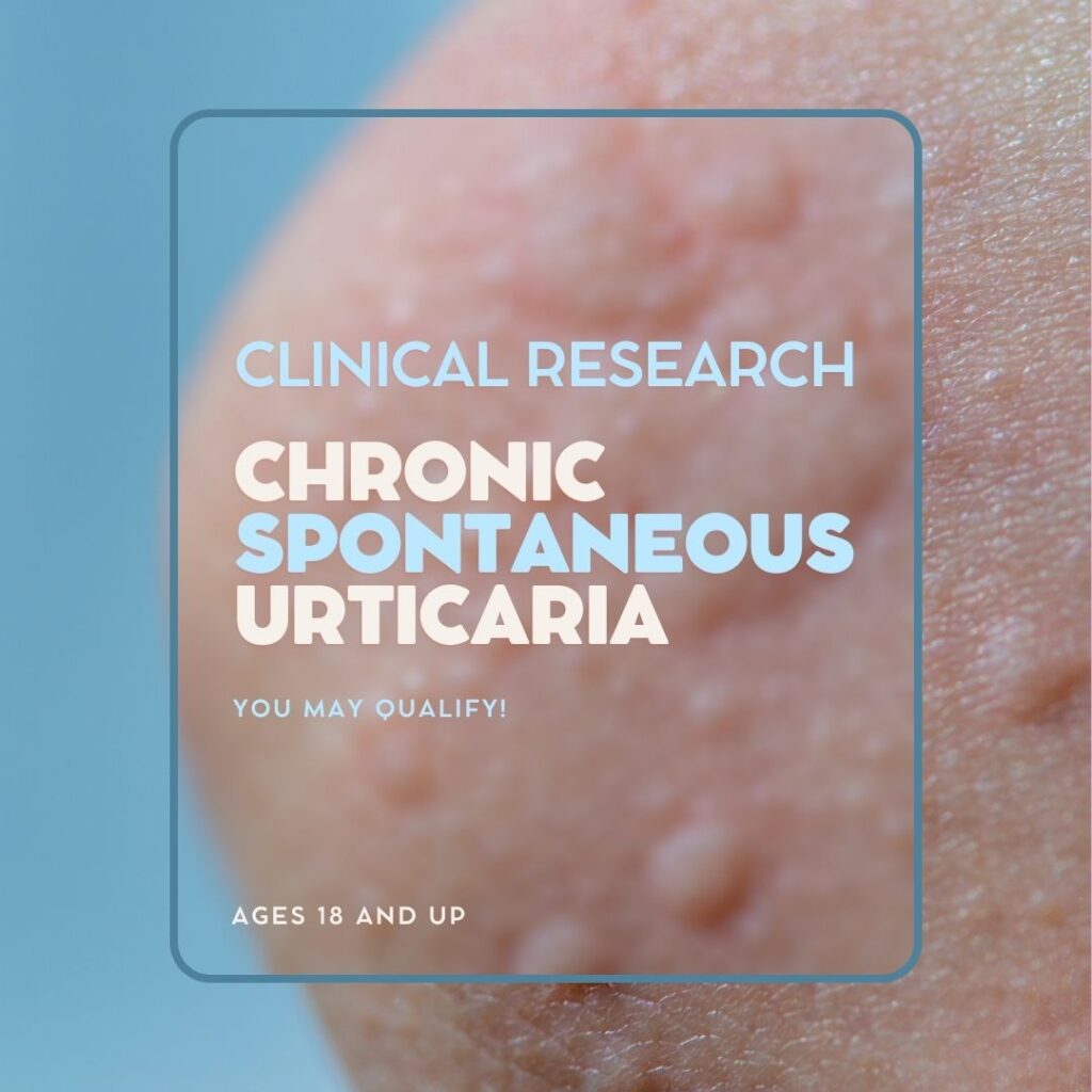 Blue, white, and pink Chronic Spontaneous Urticaria clinical research facebook ad